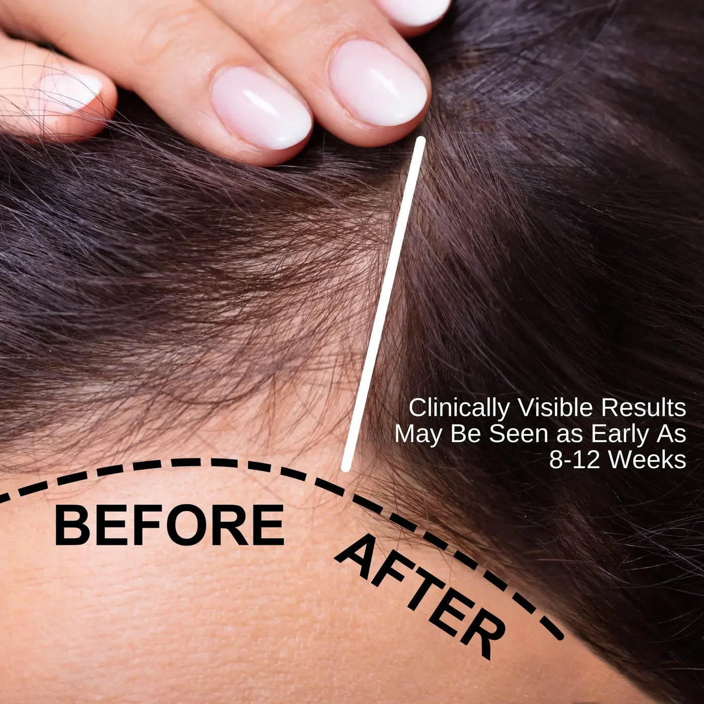 Ammuri Natural Hair Oil –  (50ml)